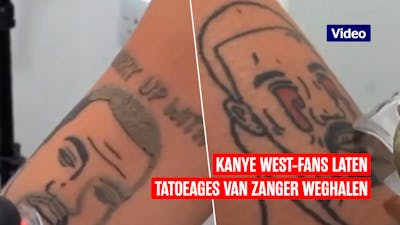 Kanye West-fans laten tatoeages van zanger weglaseren