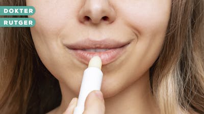 Dr. Rutger: Last van droge lippen? Dit kun je eraan doen