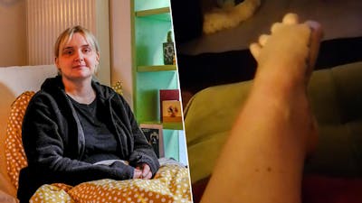 ‘Zelfmoordziekte’ dwingt Liza (29) tot voetamputatie